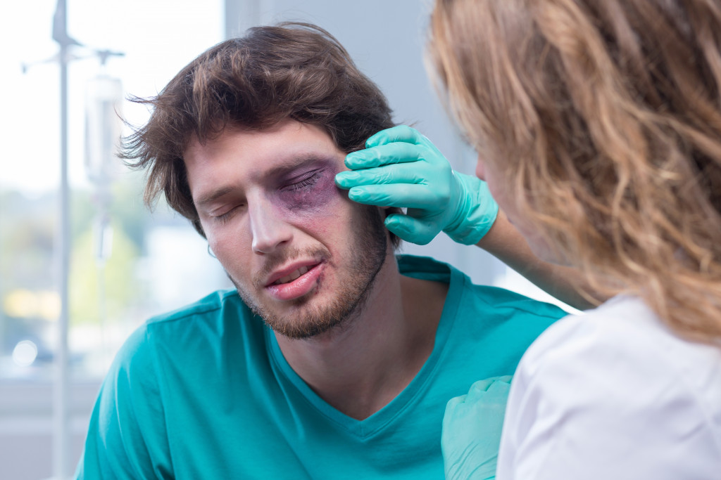 Male bruised due to physical abuse by partner